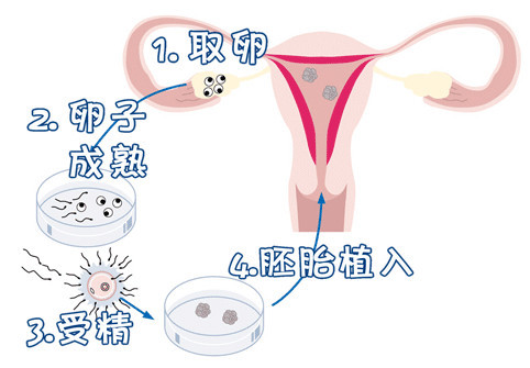 国内供卵代孕服务试管婴儿中心